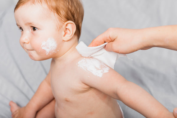 The Ultimate Guide to Treating Eczema in Babies